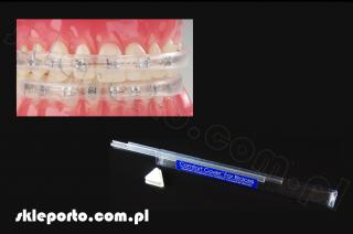 Comfort Cover silikonowy ochraniacz ortodontyczny na zamki - osłona ortodontyczna