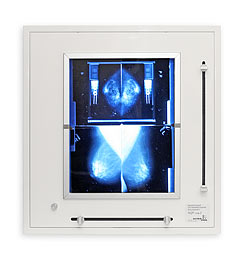 ULTRA-VIOL NGP-21 mZ negatoskop żaluzjowy do mammografii