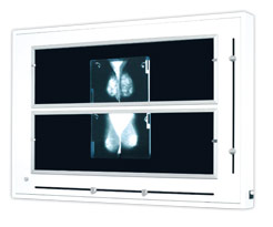 ULTRA-VIOL NGP-41 mZ negatoskop żaluzjowy do mammografii NGP-41 mZ