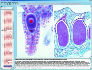 Anatomia CRYPTOGAMAE - CD-ROM ze zdjęciami preparatów mikroskopowych