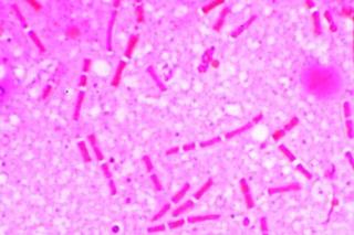 Bakterie - zestaw 25 preparatów GWARANCJA NAJNIŻSZEJ CENY