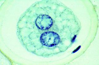 Embriologia nicieni - zestaw 10 preparatów GWARANCJA NAJNIŻSZEJ CENY