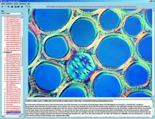 Komórka roślinna - CD-ROM ze zdjęciami preparatów mikroskopowych