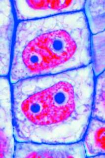 Komórka roślinna (cytologia) - zestaw studencki (6 preparatów)