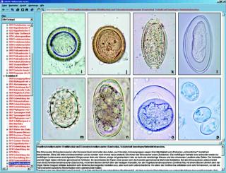 Pasożyty człowieka i choroby - CD-ROM ze zdjęciami preparatów mikroskopowych