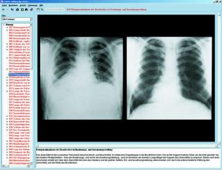 Układ oddechowy i układ krążenia człowieka. Ludzkie serce - CD-ROM ze zdjęciami preparatów mikroskopowych