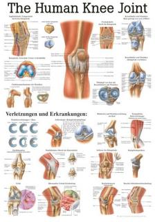 Tablica medyczna - Ludzkie kolano